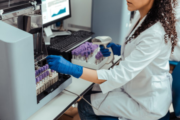 Close up of female hand taking blood sample