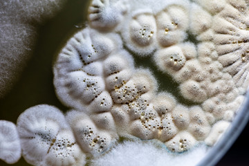 Backgrounds of Characteristics and Different shaped Colony of Bacteria and Mold growing on agar...