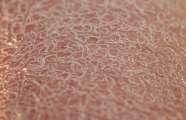texture of women's skin close-up covered with small and large cracks and dead dry flaky scales after sun exposure