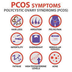 Symptoms of PCOS infographics. Detailed vector infographics.