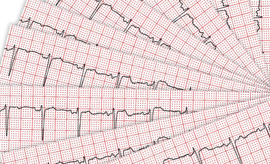 Cardiogram. A few research result by CU