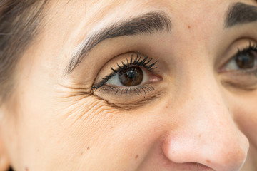 A close-up view of a young woman with brown eyes and crow’s feet. Wrinkles at the side of the eye...