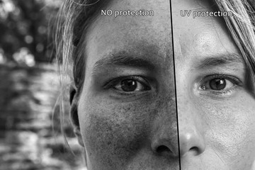 A split screen view showing the effects of sun damage on the skin. With and without UV protection....