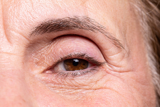 A close up view on the eye of an older woman. Elderly skin with heavy wrinkles around the eyes from natural aging.