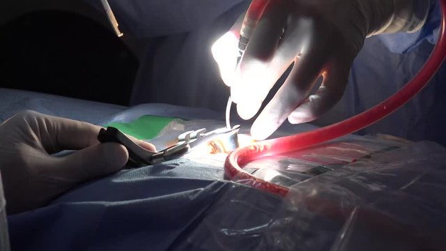 Spinal disc herniation is an injury to the cushioning and connective tissue between vertebrae, usually caused by excessive strain or trauma to the spine.