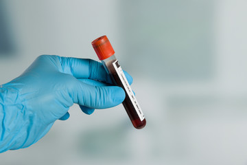 Doctor's hand with medical glove holding a blood probe in front of a lab - obrazy, fototapety, plakaty