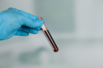Doctor's hand with medical glove holding a blood probe in front of a lab