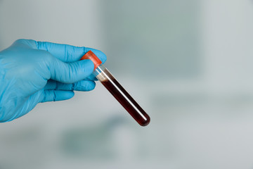 Doctor's hand with medical glove holding a blood probe in front of a lab