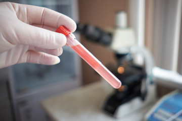 hadn with test tube full of blood, blood microscope diagnostics cross-test of Rh