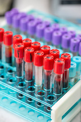 Tubes of blood sample for testing