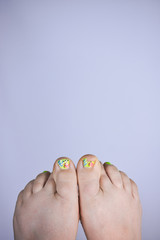 Close up of broken toe nail with cute painted. Even though the toenail is broken the women is being...