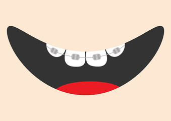 Mouth with tongue and tooth braces. Smiling face. Healthy teeth brace. Body part. Cute cartoon character. Oral dental hygiene Children teeth care icon. Baby background. Flat design