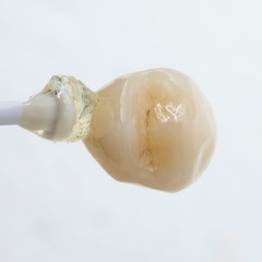 press ceramic single unit crown