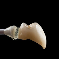 press ceramic single unit crown