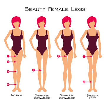 Сanon of beauty of female legs is 4 gaps in the silhouette of the legs. Set of silhouette of a female figure. Types of curvature of the legs. Vector image