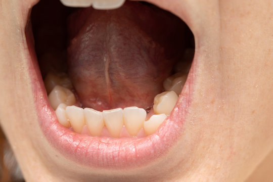 Healthy Tongue" Images – Browse 28 Stock Photos, Vectors, and Video | Adobe  Stock