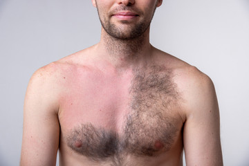 Handsome man with a lot of hair on one side of the chest and another part of the breast after waxing