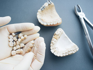 Dental prosthesis equipment and tools. Two gypsum jaws dentures crowns and bone forceps on gray...