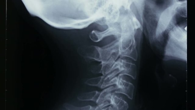 Vertical shot of a radiograph of the cervical bones and of the human skull, in lateral view.
