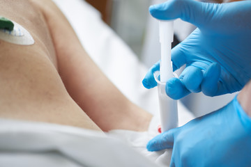 nurse's hands in blue latex gloves perfoming injection of propofol to patient for iv anesthesia