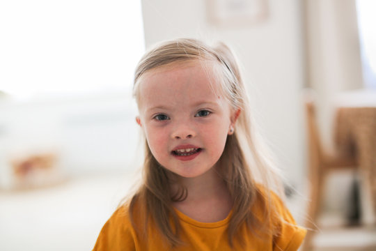 Caucasian Child Girl Blonde With Down Syndrome