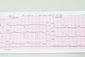 Electromyography