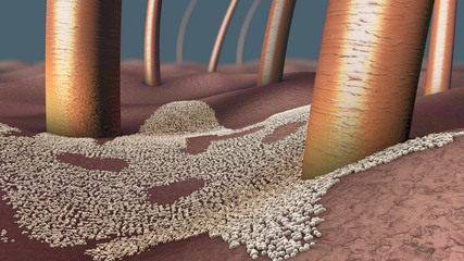 Microscopic close-up of a fungal infection of the upper skin layer, called skin mycosis - 3d illustration - obrazy, fototapety, plakaty