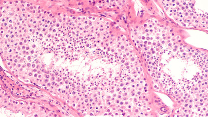 Cross section of a human testis showing seminiferous tubules with spermatogenesis, with germ cell...