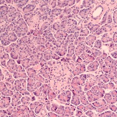 Histology of the human pancreas, largely composed of acini which excrete digestive enzymes (exocrine). In lower center is an Islet of Langerhans, which secretes hormones such as insulin (endocrine).