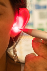 Acupunture in ear with laser