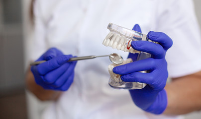 Fototapeta premium A dentist is holding a sample of jaw teeth in a dental office.
