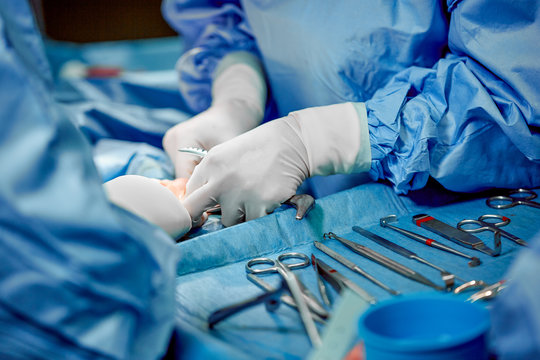 Surgical instruments and instruments, including scalpels, forceps and forceps, located on the table for surgery. Medicine, surgery, saving lives.