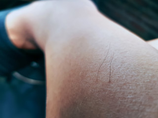 Left Over Hairs on Leg After Waxing Hair Removal