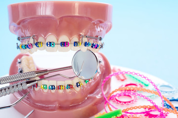 Close up dentist tools and orthodontic model  - demonstration teeth model of varities of...