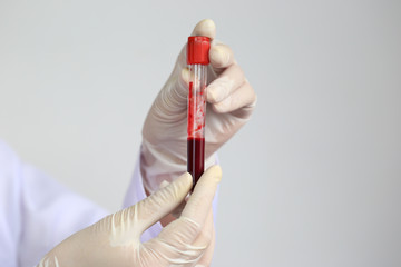 Doctor hand holding blood collection tubes in hematology laboratory, Medicine and science concept