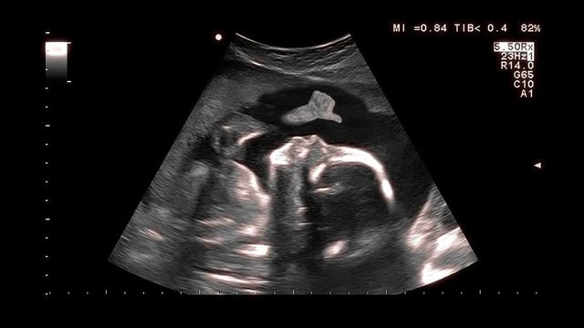 Baby in the womb, ultrasonography screen, second trimester of pregnancy. Unborn child raised his thumb up.