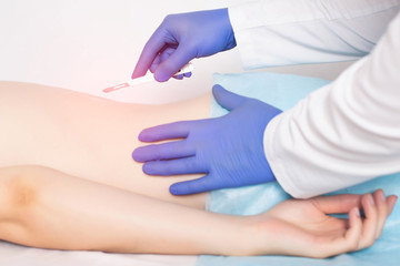 Fototapeta premium Doctor holding a surgical scalpel near the spine of the girl concept of spinal surgery diskectomy and laminectomy