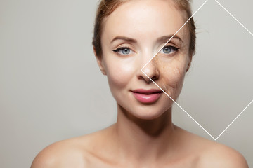 woman face with elements of young and old skin