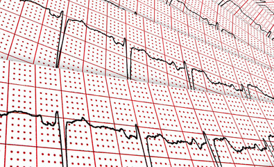 Cardiogram. A few research result by CU