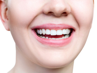 Close-up healthy smile of young woman. Perfect white teeth.
