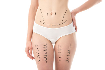 partial view of woman in panties with marks on belly and hips isolated on white