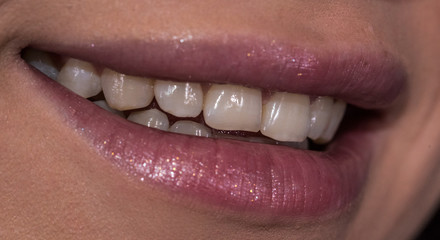 Woman smile with natural teeth