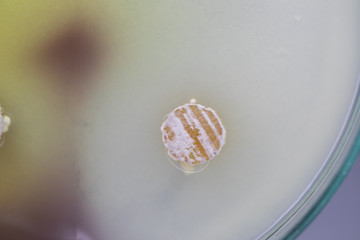 Backgrounds of Characteristics and Different shaped Colony of Bacteria and Mold growing on agar plates from Soil samples for education in Microbiology laboratory.