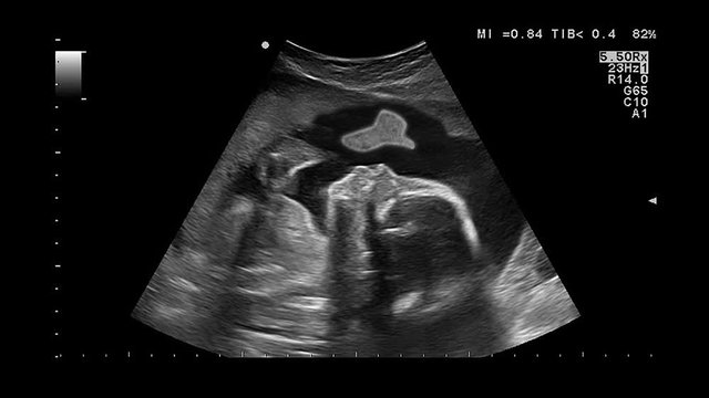 Medical examination by ultrasound of a pregnant woman. Unborn baby gives thumb up in the womb. Modern ultrasound examination during pregnancy. Seamlessly loop conceptual footage