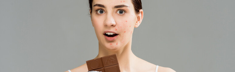 panoramic shot of surprised brunette woman with acne on face holding chocolate bar isolated on grey