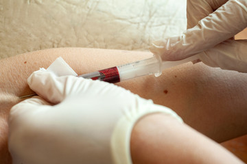 Nurse taking Real Blood samples (Phlebotomist) for analysis from a patient