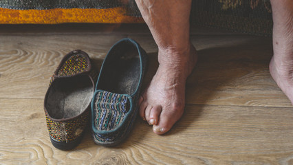 old feet, damaged toes and wrinkled legs with veins of old woman. old shoes with holes. risk group coronavirus or covid virus