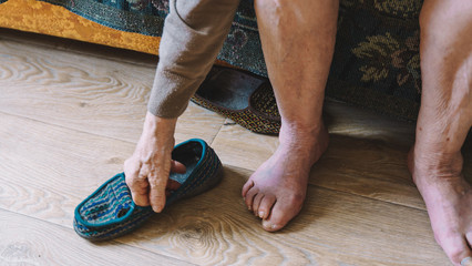 old feet, damaged toes and wrinkled legs with veins of old woman. hand, arm of aged person. taking...