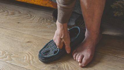 old feet, damaged toes and wrinkled legs with veins of old woman. hand of aged person taking old shoes with holes.