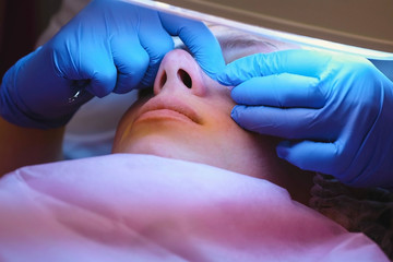 Facial cleansing at the beautician. Squeezing pimples on the nose with a needle and magnifier. Close-up face